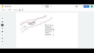 SNAB 1 6 blood clotting