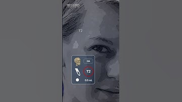 T2 - MD Codes Review