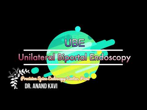 UBE : Unilateral Biportal Endoscopic Spine surgery