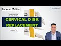 Cervical Disk Arthroplasty (Disk Replacement) Explained
