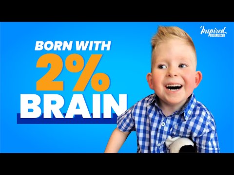 Noah the miracle - Boy born with just 2% brain