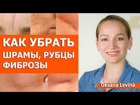 Как убрать рубцы и шрамы на коже. Шрамы после прыщей, рубцы на теле и другие фиброзы