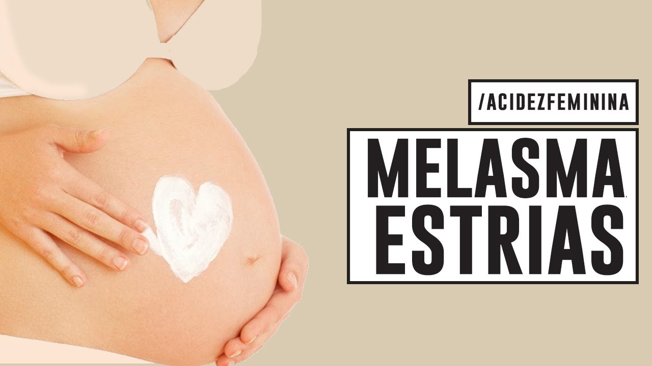 CUIDADOS com a PELE na GRAVIDEZ | MELASMA, ESTRIAS, ACNE, VARIZES com Dra Cintia Cunha