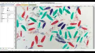 ImageView Microscope Camera Software: Reports screenshot 2