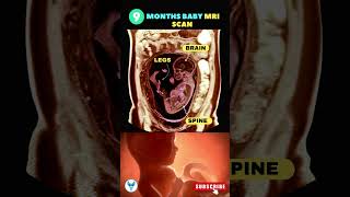9 month baby ❤️ 9 Month pregnancy scan | Scans in Pregnancy | Fetus on MRI baby shortsvideo scan
