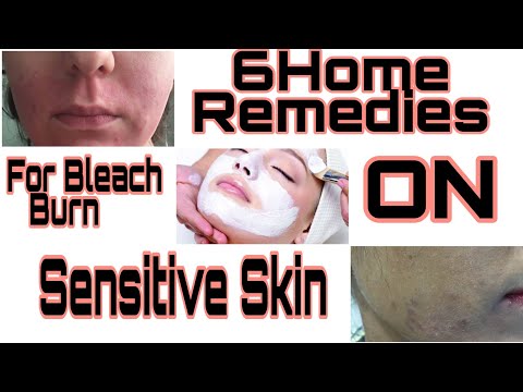 6 Home Remedies For Bleach Burn On Sensitive Skin🔥by @Dolliee Dayal