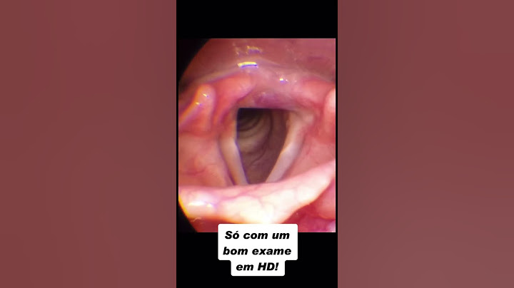 Vendo as cordas vocais