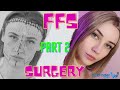How to not FAIL your Facial Feminization Surgery in Korea Part 2