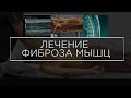 Фиброз мышц лечение.Миофиброз  на МРТ.Миопрессура.  Триггерные точки.