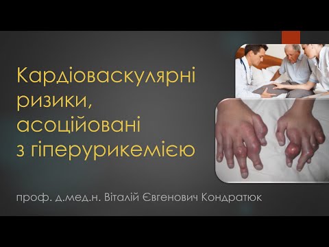 Кардіоваскулярні ризики, асоційовані з гіперурикемією