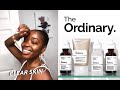 The Ordinary - 3 Month SKIN UPDATE + Full Review | How I Got Rid of Hyperpigmentation + Dark Spots!