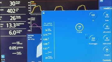 Understanding Ventilator Graphics: Short Rise Time & Pressure Overshoot