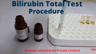 Bilirubin Test Procedure | Bilirubin Total Test