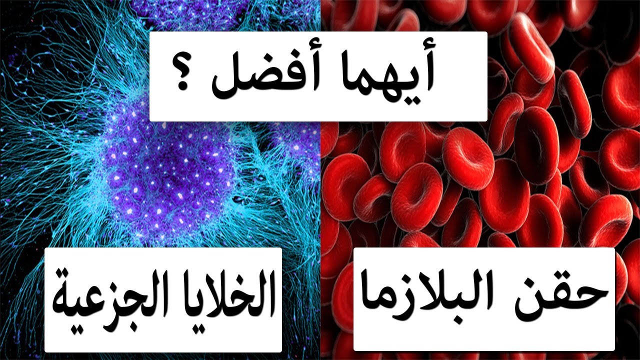 حقن البلازما أفضل ام حقن الخلايا الجذعية؟