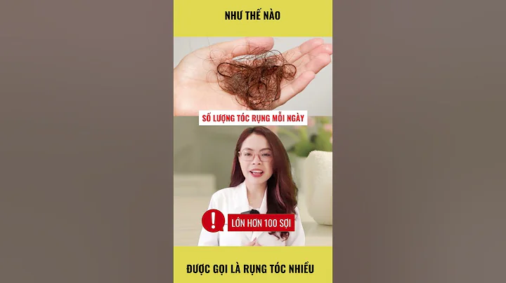 What is considered severe hair loss #shorts - Doctor Nguyen