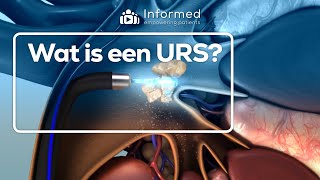 Wat is een ureterorenoscopie (URS)?