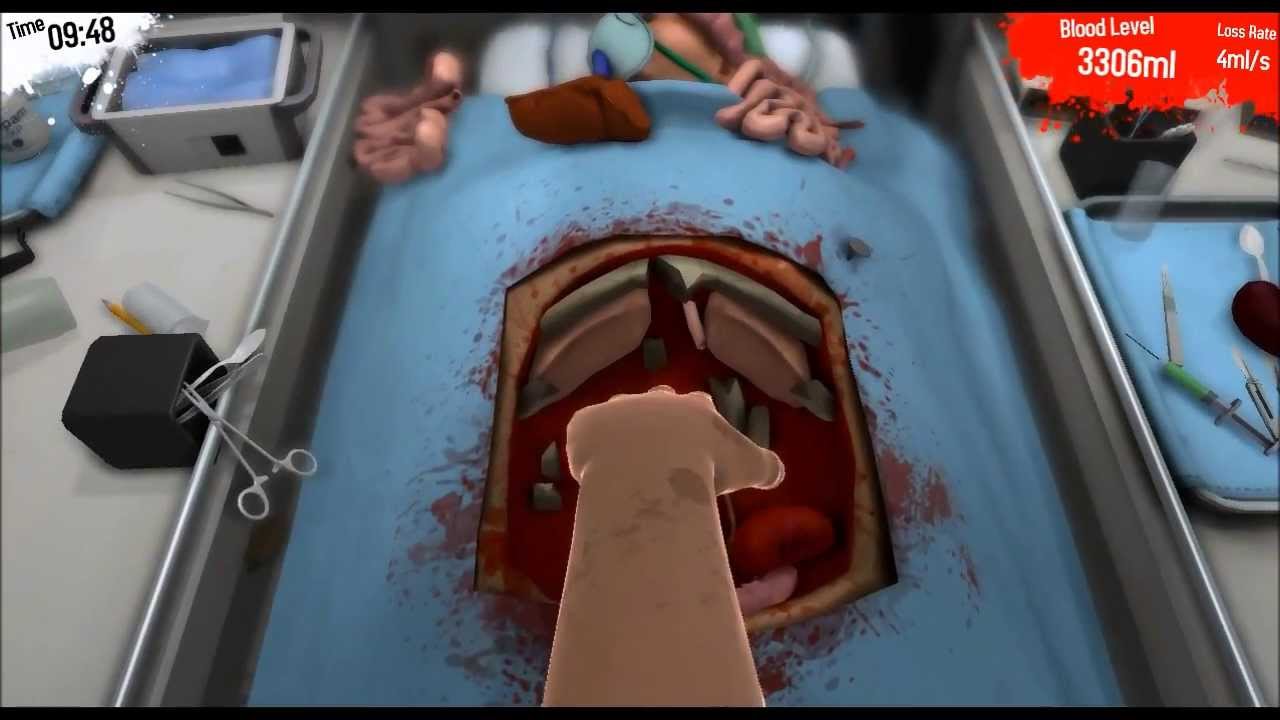 double kidney transplant surgeon simulator where to cut double kidney transplant surgeon simulator where to cut