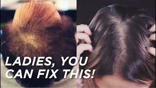 Women: This is How You Fix Thinning Hair!