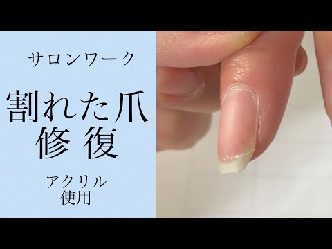 割れ た 爪 くっつく 割れ た 爪 くっつく