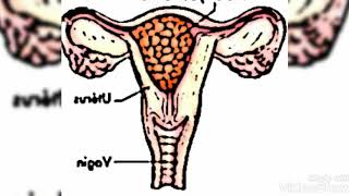 الحمل العنقودي***** la grossesse molaire *****