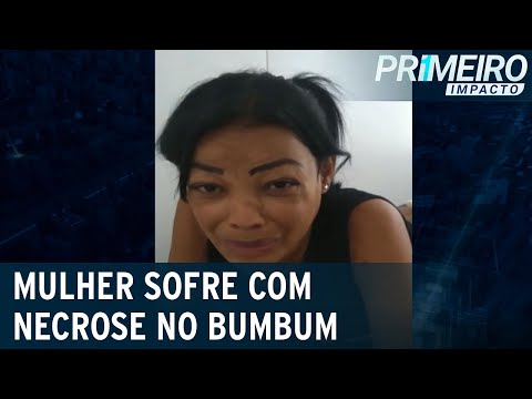 Vídeo: Mulher Transgênero Morre Após Cirurgia De Lifting De Nádega