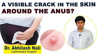 Haqiqiy jinsiy aloqa ogli onasini sikadi Yalangoch Karolin Voznyackining fotosurati