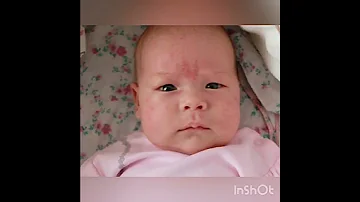 Красные пятна на коже новорожденного