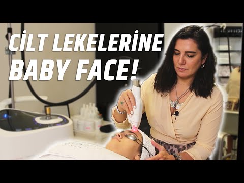 Baby Face Beauty ile Cilt Lekelerine Çözüm