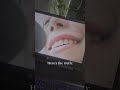 STOP BOOSTING POSTS — It’s Killing Your Dental Ads