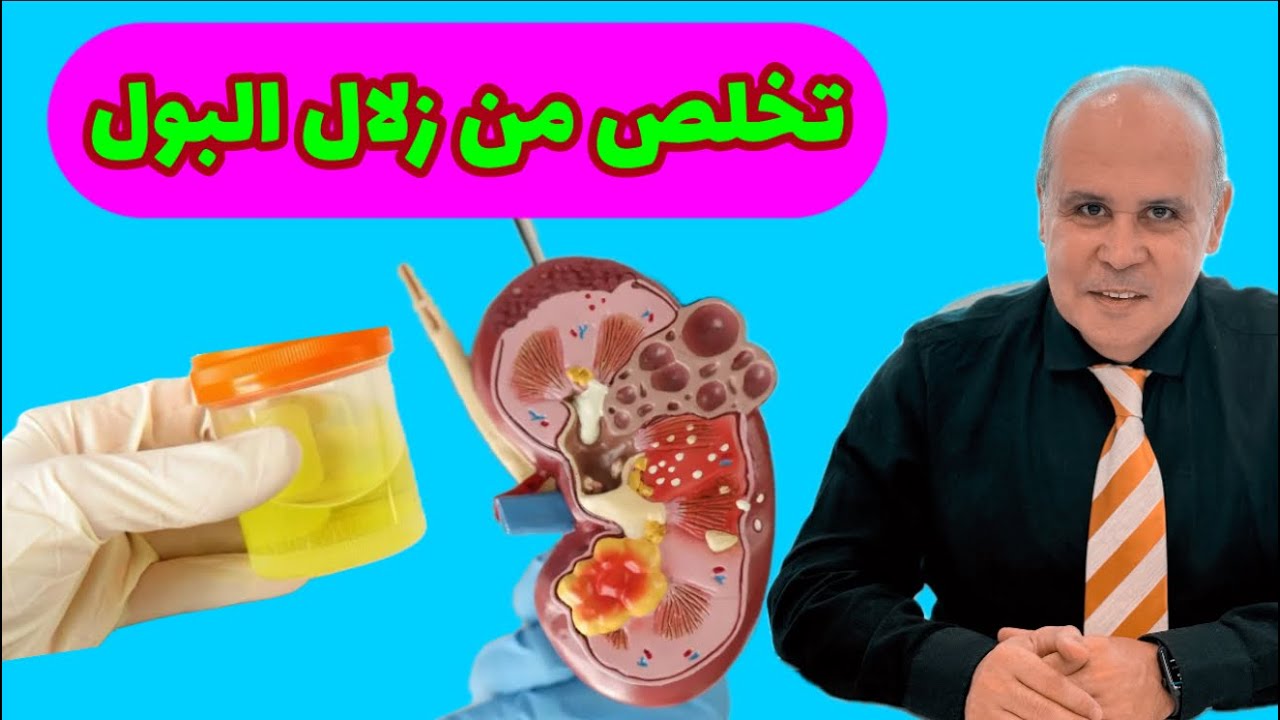 أخيرا ..علاج زلال البول وخلل وظائف الكلي..أخطر مضاعفات الكلي