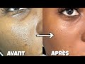 COMMENT RESSERRER LES LARGES PORES DILATÉS INSTANTANÉMENT | Fatim COAST