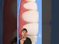これが審美治療だ Shorts ダイレクトボンディング 歯医者 歯科衛生士 雑学 歯医者あるある 自費治療 前歯 セラミック治療 これが審美治療だ Shorts ダイレクトボンディング 歯医者 歯科衛生士 雑学 歯医者あるある 自費治療 前歯 セラミック治療