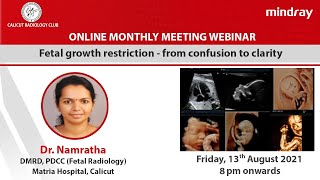 Fetal Growth Restriction-from Confusion to Clarity by Dr. Namratha, MBBS, DMRD, PDCC-Fetal Radiology screenshot 4