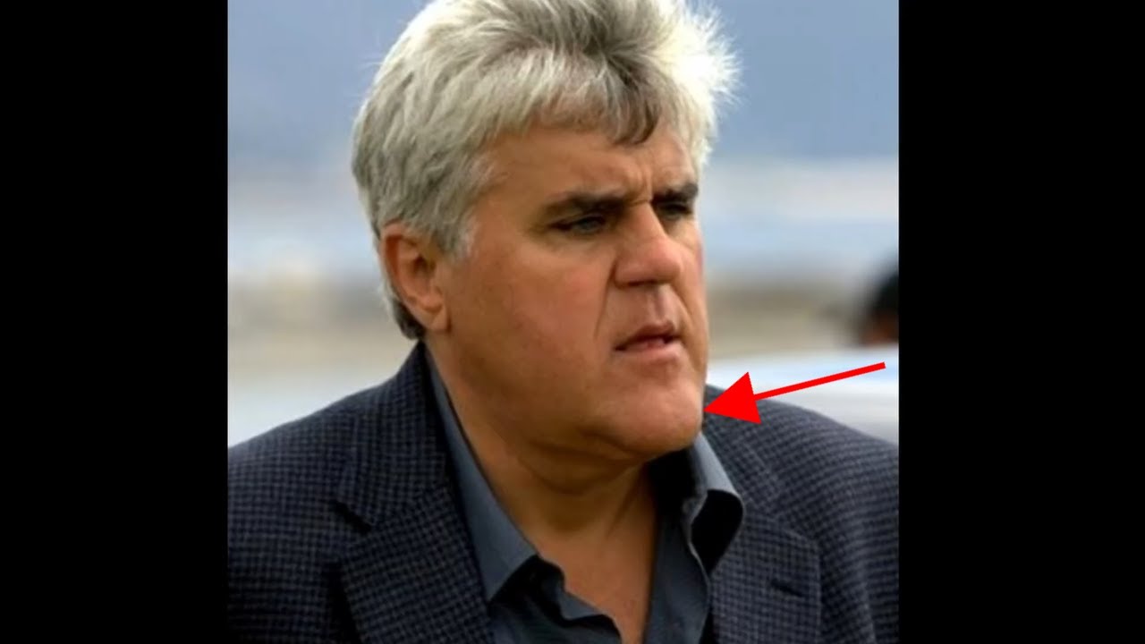 Humans Are the Only Animals With a Chin and We Finally Know Why