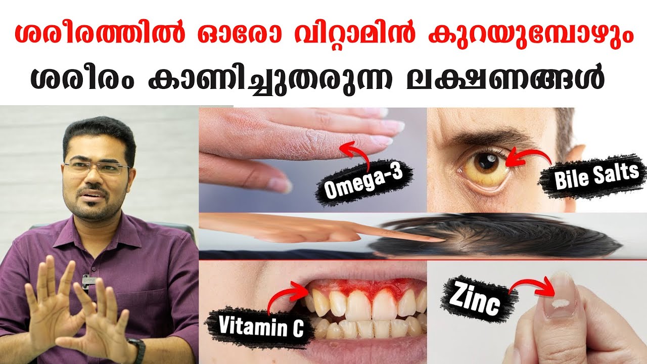 ശരീരത്തിൽ ഓരോ വിറ്റാമിൻ കുറയുമ്പോഴും ശരീരം കാണിച്ചുതരുന്ന ലക്ഷണങ്ങൾ  /Dr Manoj Johnson