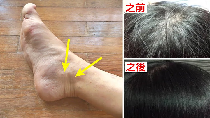 白髮越來越多，別急著染髮！只需要按摩一個穴道，白髮全沒了！黑髮重新長出來，讓人年輕10歲！ - 天天要聞