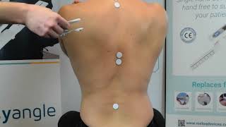 Easyangle Spinal Measurements - Lumbar Rotation