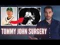 Doctor Explains Pitcher Dies After Tommy John Surgery