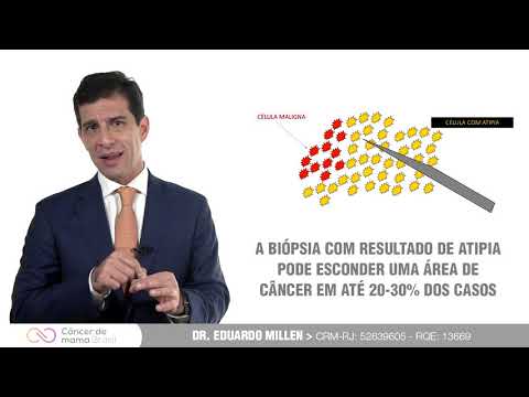 Vídeo: A hiperplasia lobular atípica pode desaparecer?