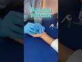 Punción seca del oponente del pulgar 💥#puncionseca #dryneedling #fisioterapia