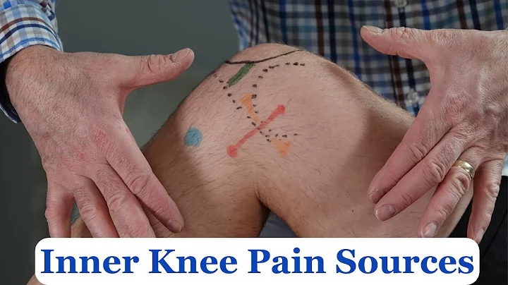 5 Most Common Sources of Inner Knee Pain