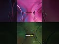 How to anamorphic DE squeeze Visit https://anamorphic-desqueeze.com #anamorphic #iosfilmmaking #ios