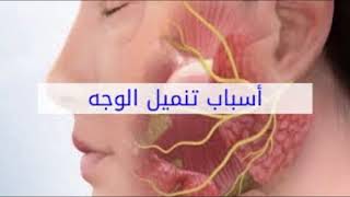 أسباب تنميل الوجه