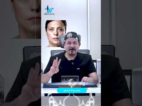 70 من البنات يحتاجون إبرة الكوليز