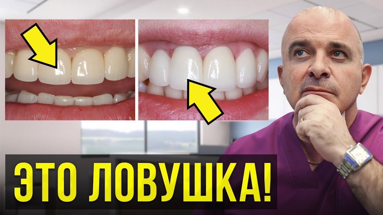 Какая посуда лучше: керамика или фарфор?