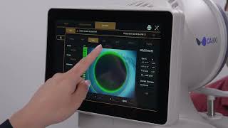 Topcon CA-800: Contact Lens Simulation Module