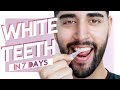 Whiter Teeth In 7 Days - At Home Teeth Whitening ✖ James Welsh