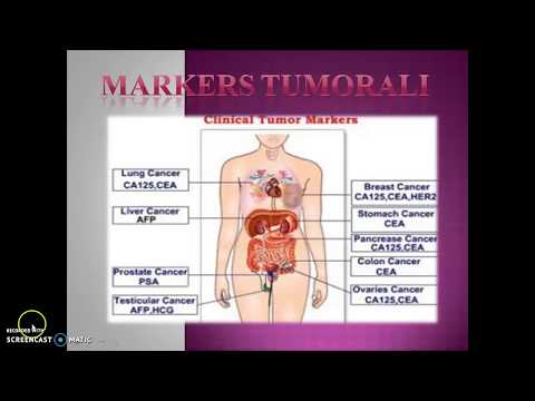 markeri tumorali pentru prostata