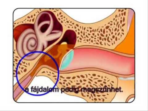 Videó: Hogyan működik a dobhártya?