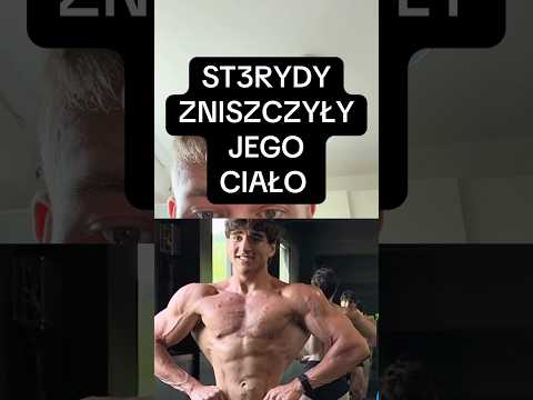 Mr triceps jacob oestreicher zniszczył się sterydami #shorts
